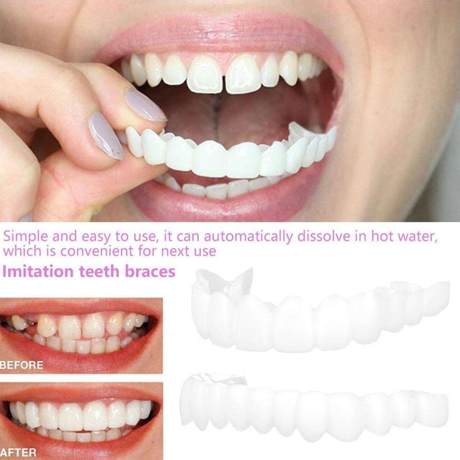 Teeth Whitening Moulds - 2 szt. Tymczasowe nakładki na zęby