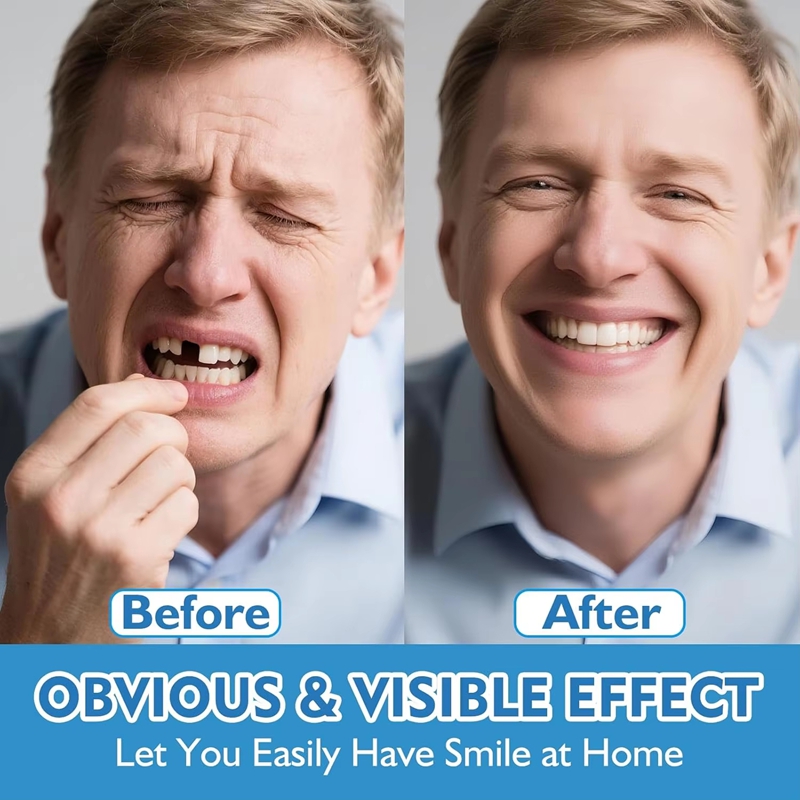 Kompletne silikonowe protezy g – Teeth Whitening Moulds recenzja i cena