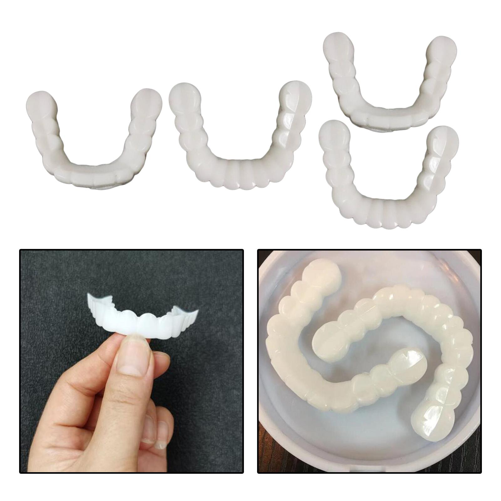 Nakładka na zęby wybielająca w – Teeth Whitening Moulds recenzja i cena