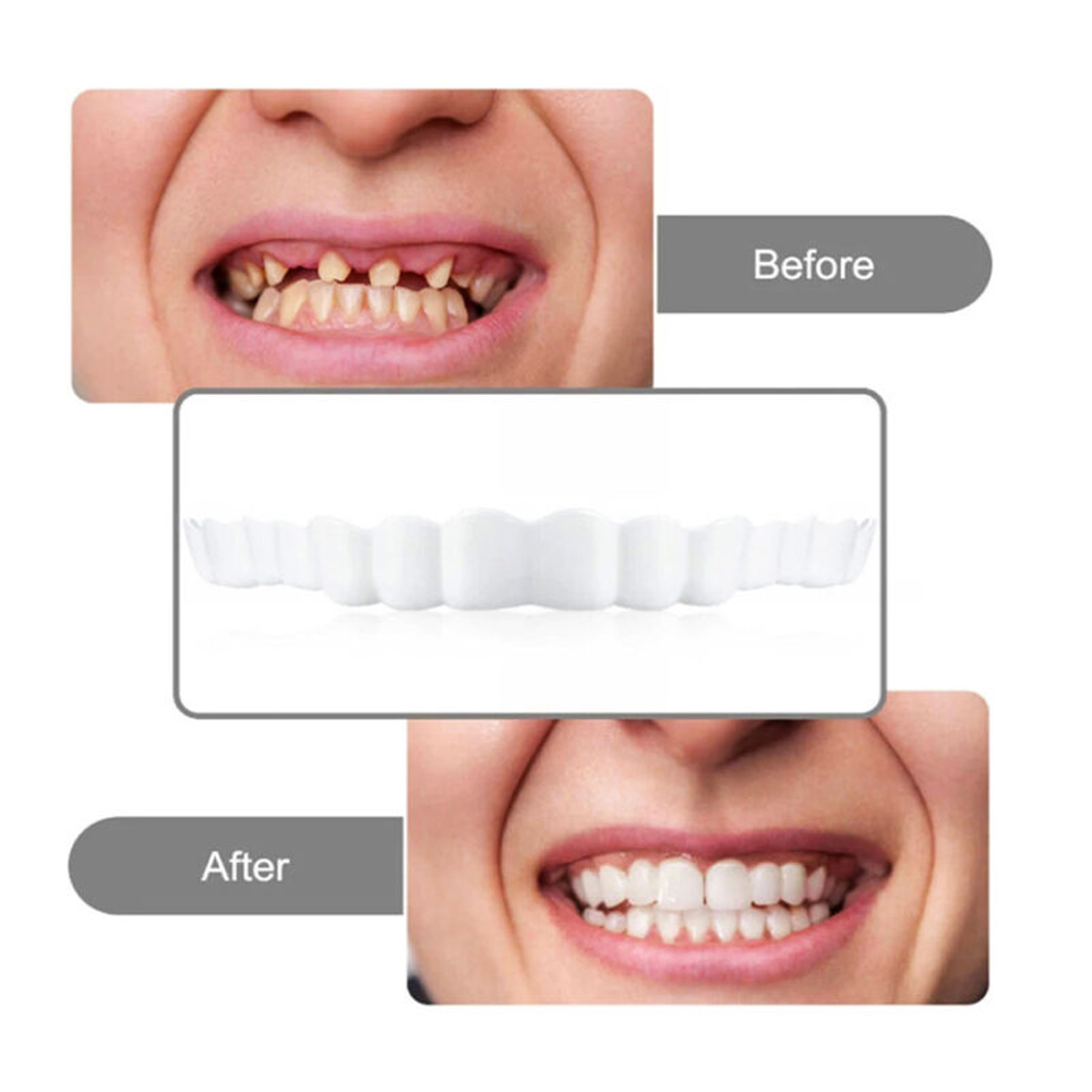 4-6 par protez górnych i dolny – Teeth Whitening Moulds recenzja i cena