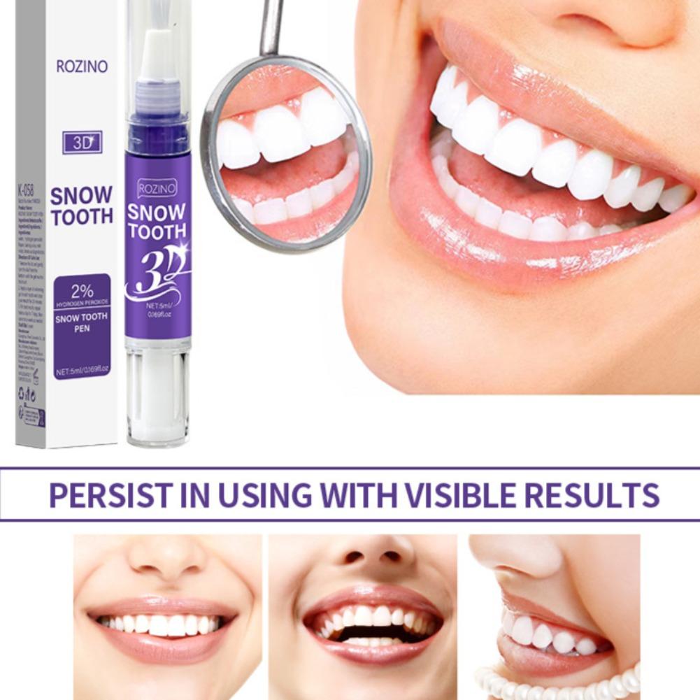 3D długopis do wybielania zębó – Teeth Whitening Pens recenzja i cena