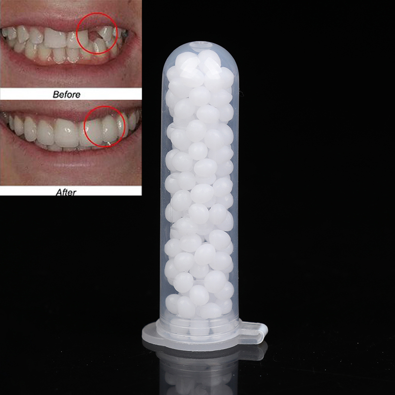 【K】1 zestaw do tymczasowego na – Teeth Whitening Kit recenzja i cena