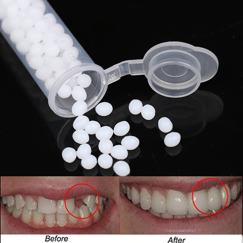 【K】1 zestaw do tymczasowego na – Teeth Whitening Kit recenzja i cena