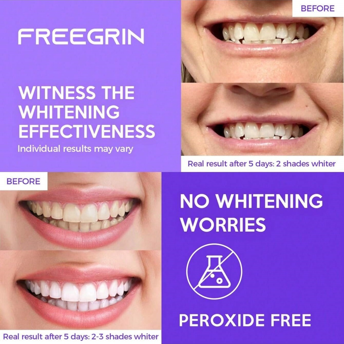 Naklejki wybielające do zębów  – Teeth Whitening Near Me recenzja i cena