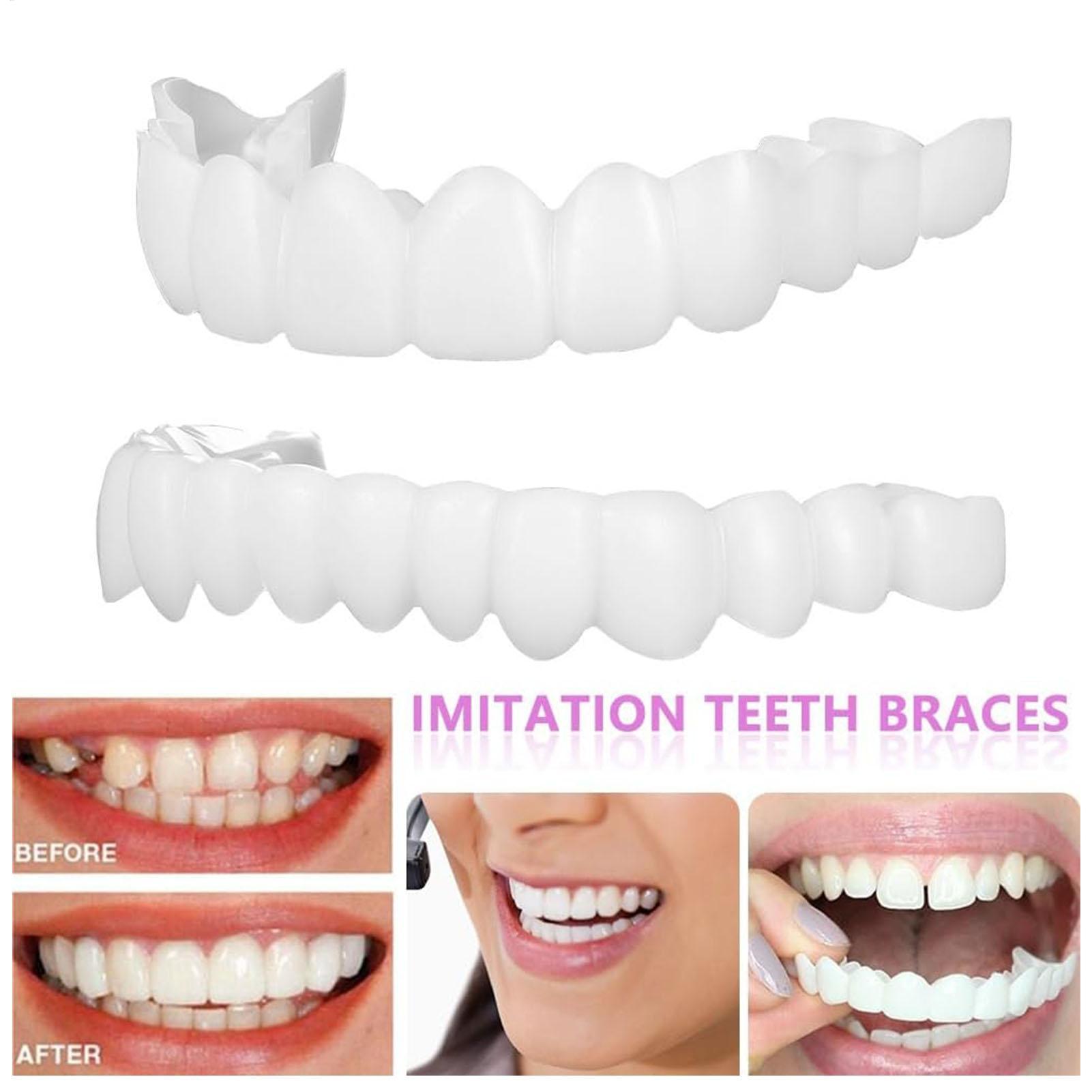 2 szt. Tymczasowe nakładki na  – Teeth Whitening Moulds recenzja i cena