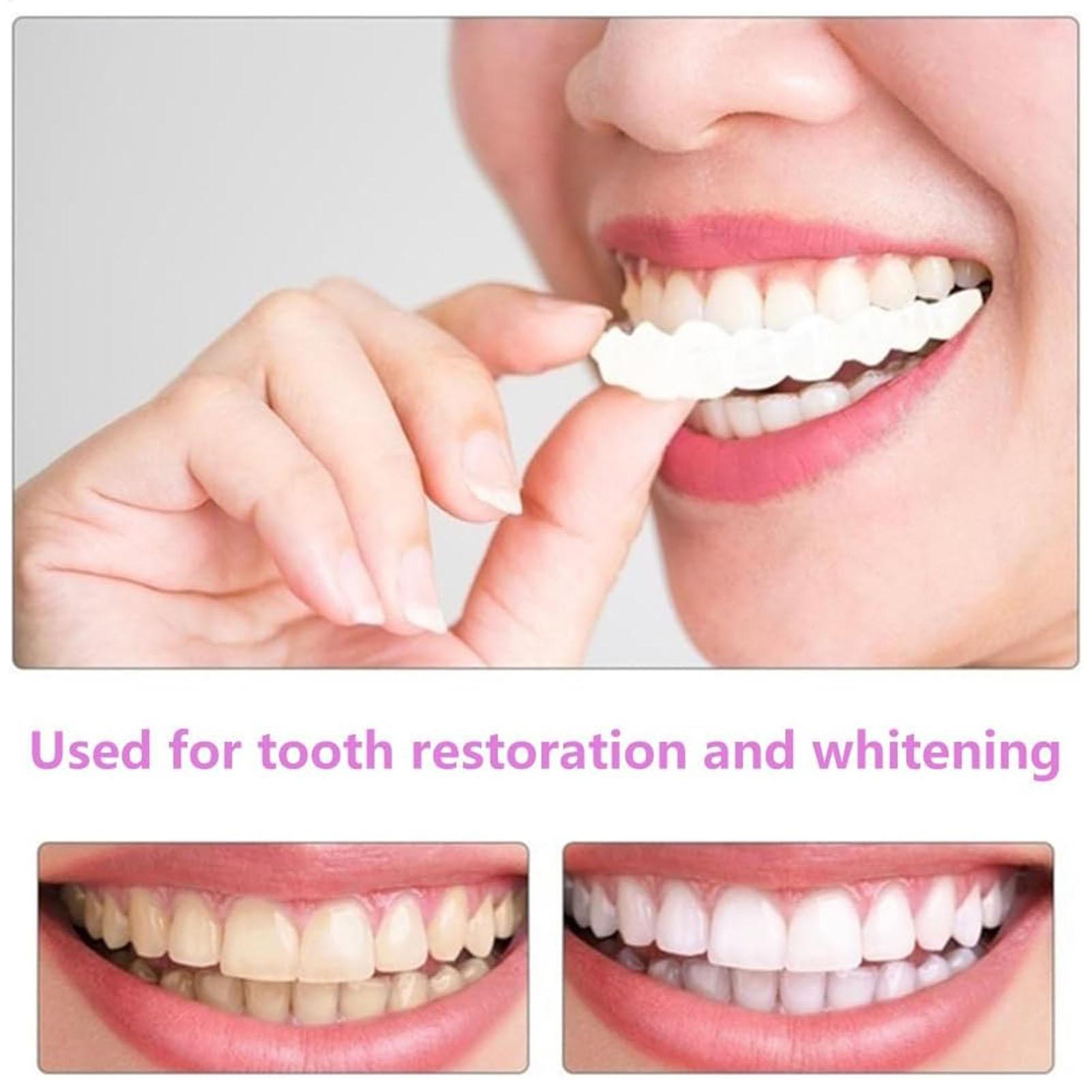 2 szt. Tymczasowe nakładki na  – Teeth Whitening Moulds recenzja i cena
