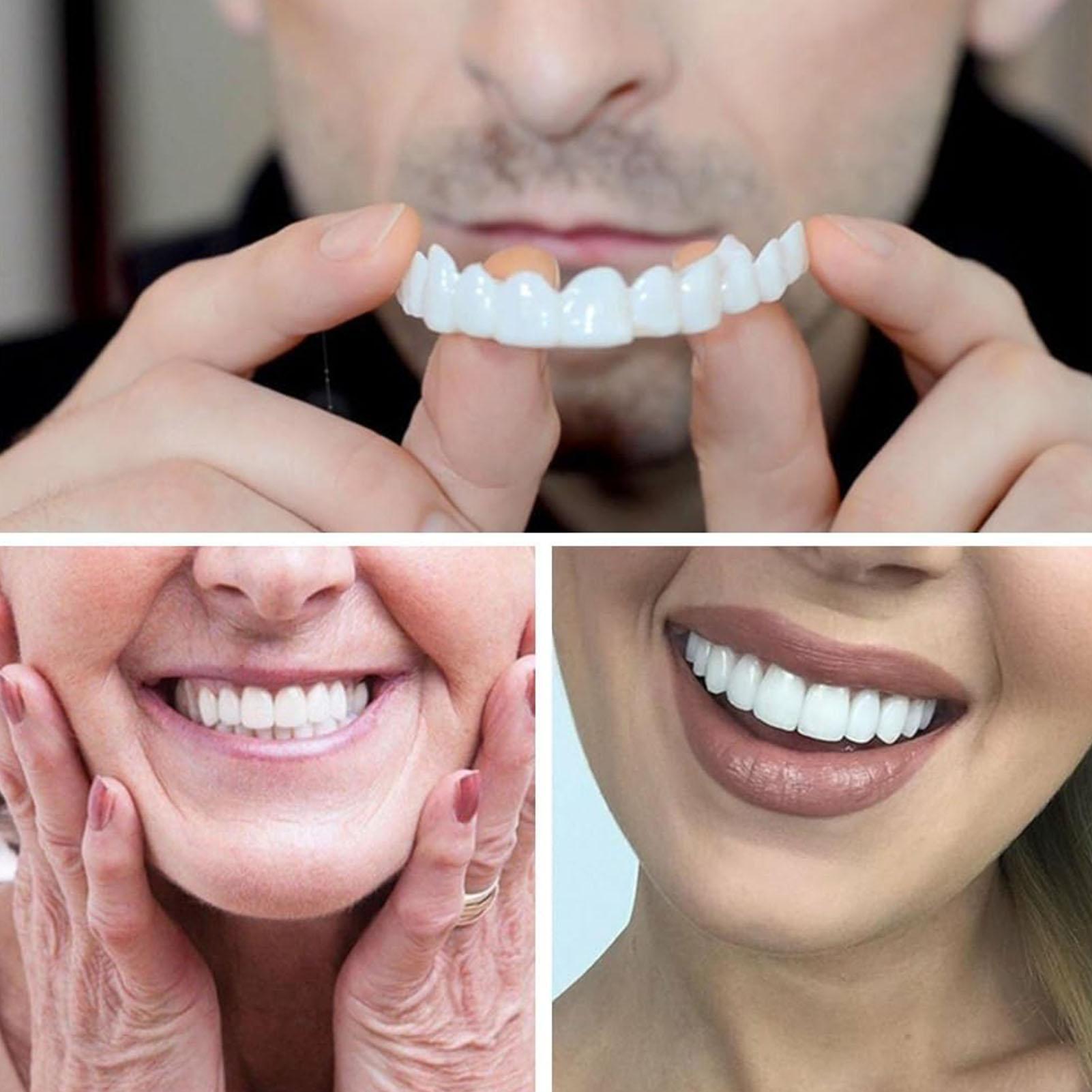 2 szt. Tymczasowe nakładki na  – Teeth Whitening Moulds recenzja i cena